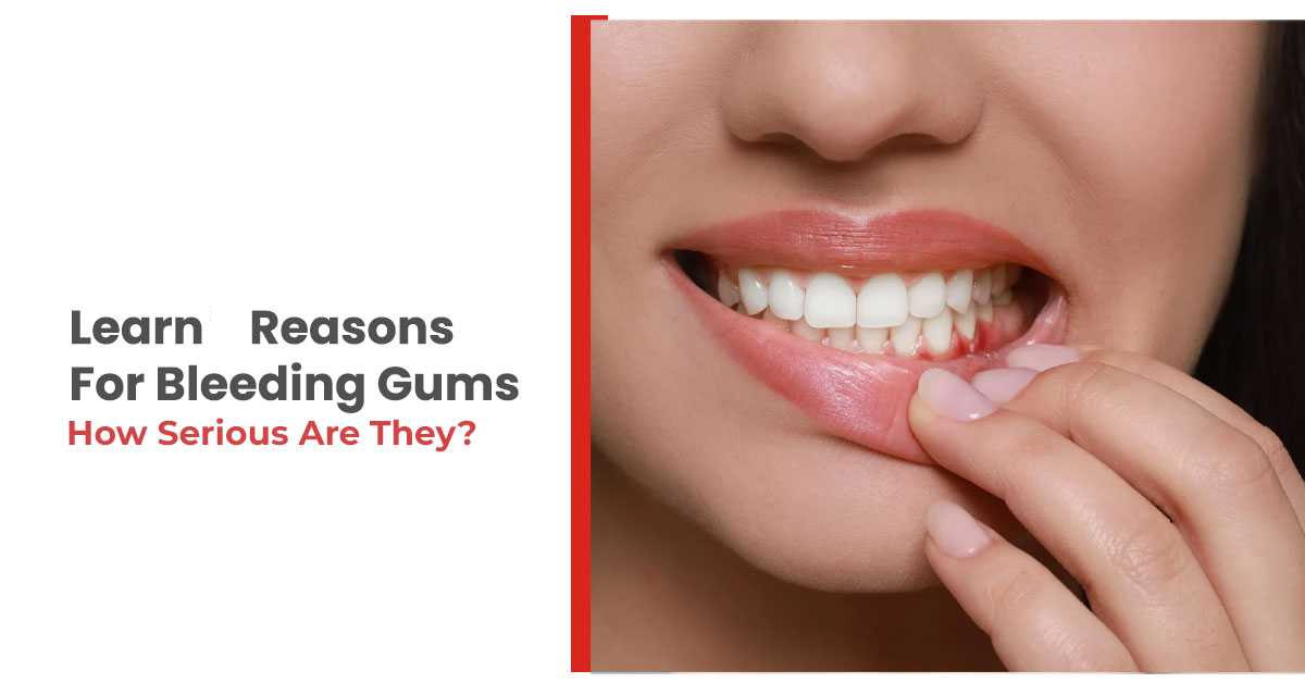 Why Are Your Gums Bleeding? 7 Possible Reasons You Should Know
