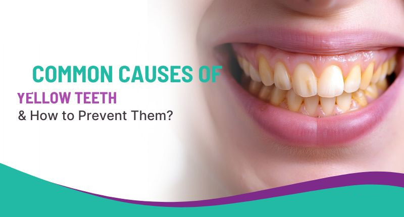 What Causes Yellow Teeth and How Can You Prevent Them?